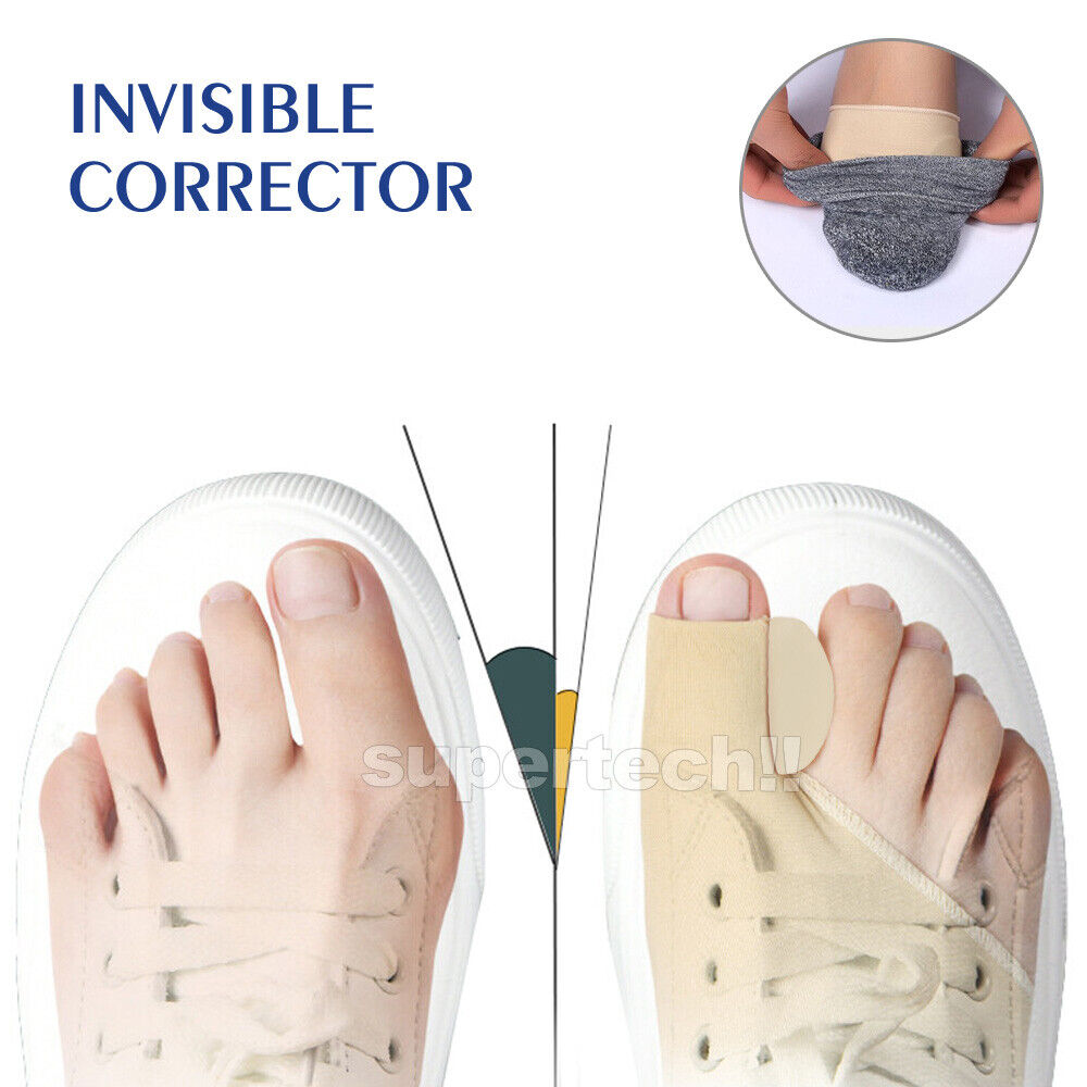 Toe Straightener Corrector