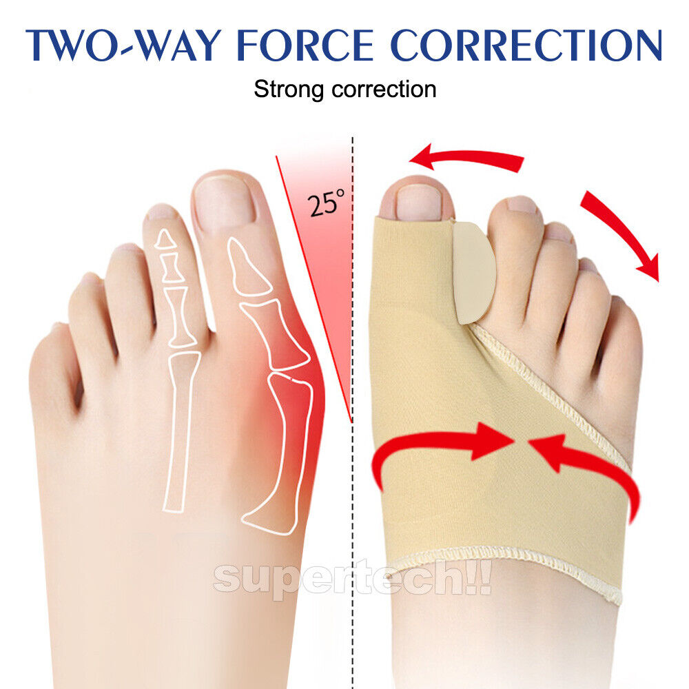 Toe Straightener Corrector